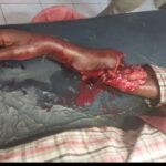 *హైదరాబాద్ నాగార్జునసాగర్ రహదారిపై ఘోర ప్రమాదం బైక్ను ఢీకొట్టిన ట్రాక్టర్ ఇద్దరు కొడుకులు మృతి*