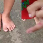 వీధి కుక్కల బేధత