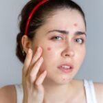 బహురూపి బియ్యంతో భోజనాలు – గోశాలలో ప్రత్యేక విందు