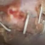 ఇసుక అక్రమ రవాణా కేసులో కీలక నిందితుడు అరెస్ట్
