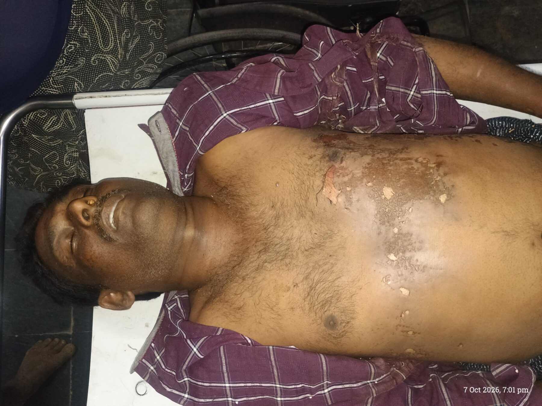 విద్యుత్ లైన్ తగిలి ఫీల్డ్ అసిస్టెంట్ మృతి