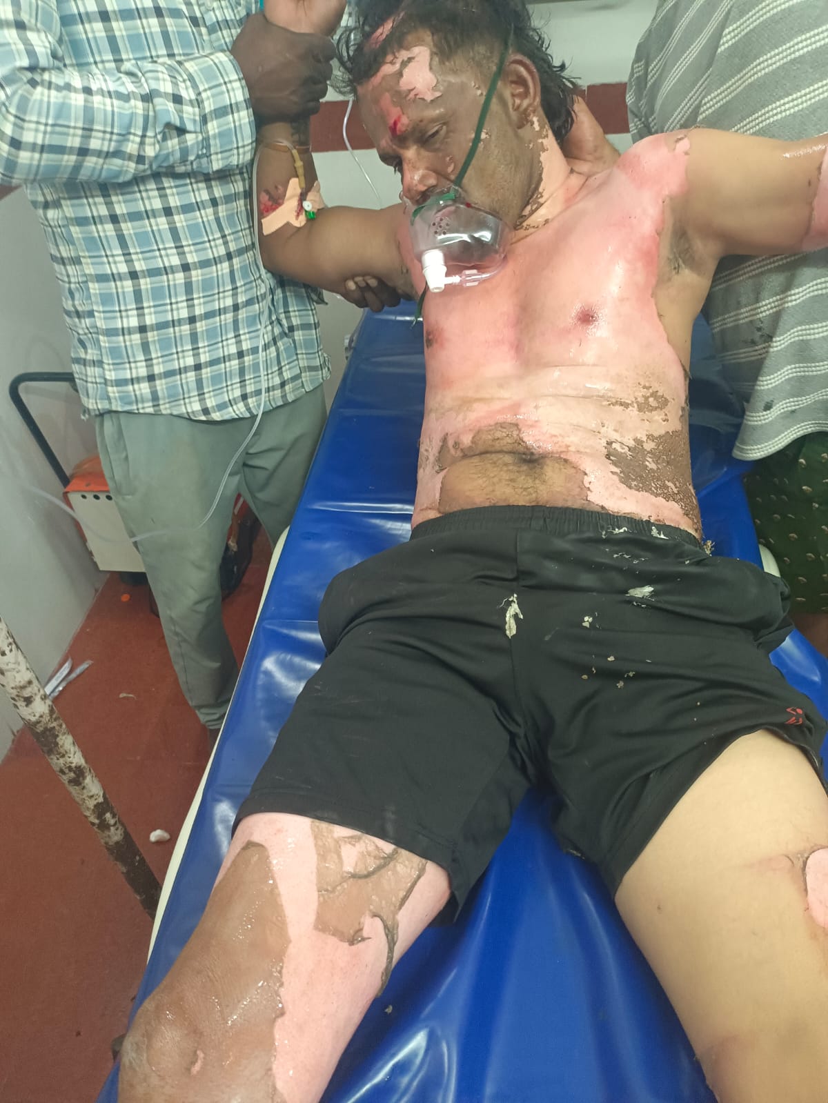 విద్యుత్ షాక్‌తో లైసెన్స్‌డ్ సర్వేయర్ సుధాకర్‌కు గాయాలు
